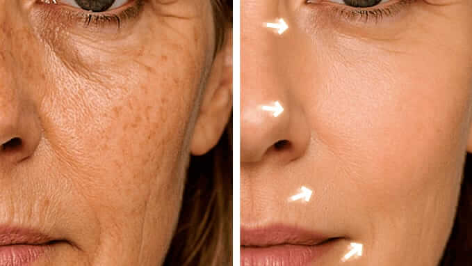 Saam Renewal Face Cream