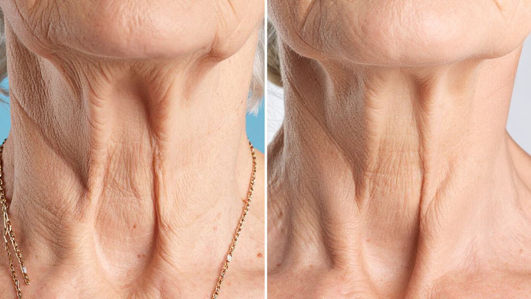 Saam Renewal Face Cream