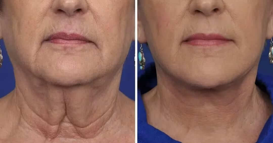 Saam Renewal Face Cream